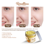 Rosallina Kojic Acid Exfoliating Pads – 60 Count
